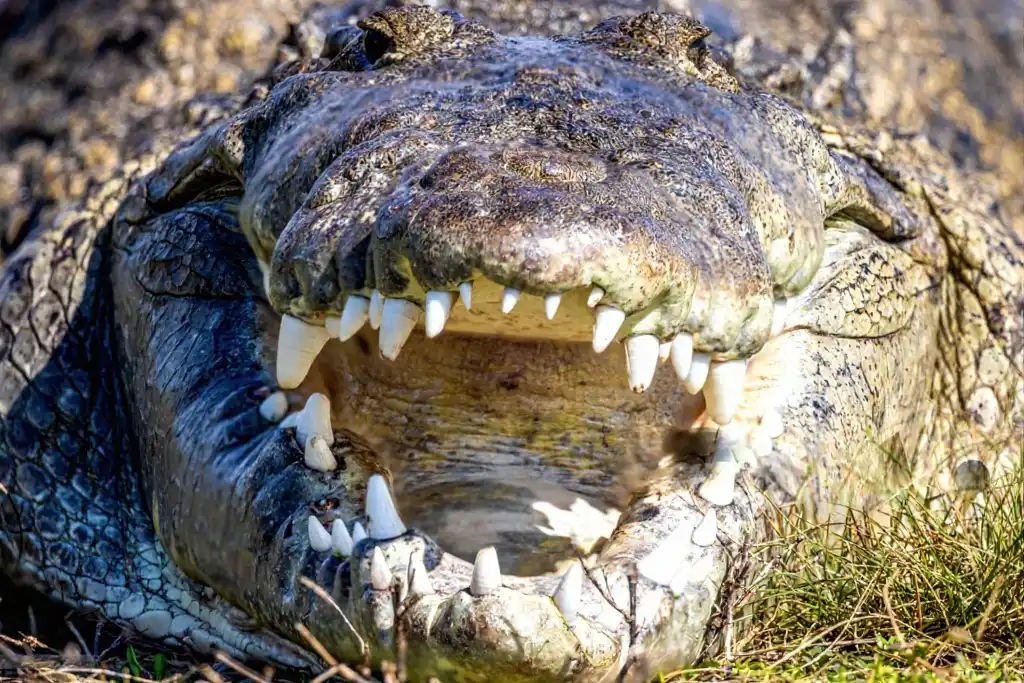 The High Price of Fear: Why Avoiding the Dentist Costs More Than You Think